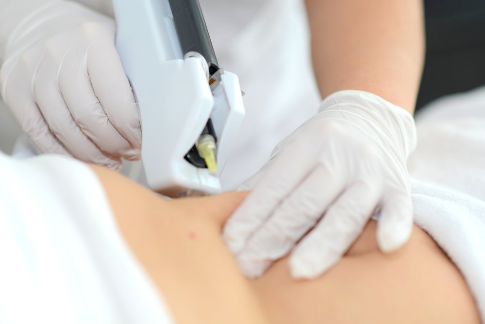 Mesoterapia 2017 Mesoterapia 2017
